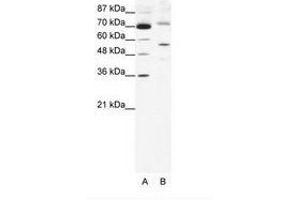 Image no. 1 for anti-Sirtuin 3 (SIRT3) (AA 152-201) antibody (ABIN203108) (SIRT3 Antikörper  (AA 152-201))