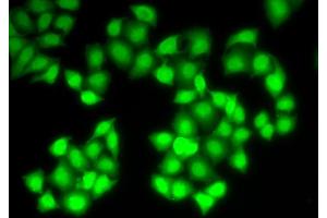 Immunofluorescence analysis of HeLa cells using DNASE1 antibody (ABIN5971366). (DNASE1 Antikörper)
