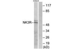Western blot analysis of extracts from COLO205 cells, using NK3R Antibody. (TACR3 Antikörper  (AA 401-450))