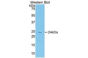 Western blot analysis of the recombinant protein. (Peroxiredoxin 5 Antikörper  (AA 1-210))