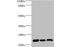 Western blot All lanes: RPL9 antibody at 0. (RPL9 Antikörper  (AA 1-192))