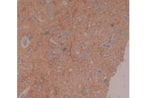 IHC-P analysis of Rat Tissue, with DAB staining. (Coagulation Factor IX Antikörper  (AA 61-263))