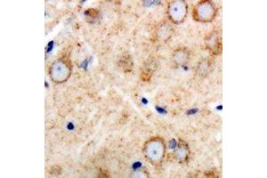 Immunohistochemical analysis of GAS3 staining in human brain formalin fixed paraffin embedded tissue section.
