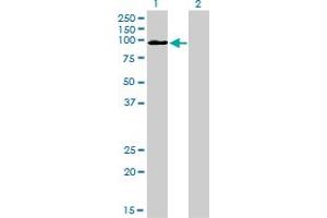 Western Blot analysis of MCC expression in transfected 293T cell line by MCC monoclonal antibody (M01), clone 1A7. (MCC Antikörper  (AA 31-130))