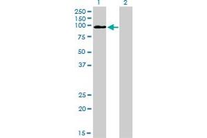 Western Blot analysis of MCC expression in transfected 293T cell line by MCC monoclonal antibody (M01), clone 1A7.