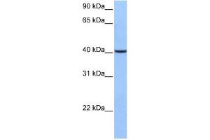 AGBL5 antibody used at 1 ug/ml to detect target protein. (AGBL5 Antikörper  (C-Term))