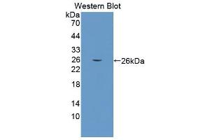Western blot analysis of the recombinant protein. (COL6a3 Antikörper  (AA 2009-2205))
