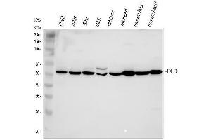 Western blot analysis of DLD using anti-DLD antibody (ABIN3043561). (DLD Antikörper  (AA 300-509))