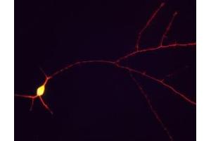 Immunofluorescence of cultured rat hippocampal neurons showing staining of tau in red along the neuronal processes. (MAPT Antikörper)