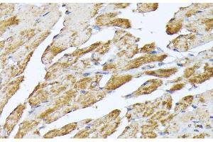Immunohistochemistry of paraffin-embedded Mouse heart using SLC25A5 Polyclonal Antibody at dilution of 1:100 (40x lens). (SLC25A5 Antikörper)