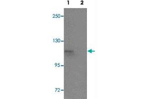 Western blot analysis of SCUBE1 in Daudi cell lysate with SCUBE1 polyclonal antibody  at 1 ug/mL in (1) the absence and (2) the presence of blocking peptide. (SCUBE1 Antikörper  (Internal Region))