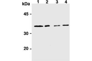 Western Blotting (WB) image for anti-Syntaxin 6 (STX6) antibody (ABIN492572) (Syntaxin 6 Antikörper)