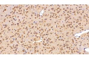 Detection of C3 Convertase in Mouse Cerebrum Tissue using Polyclonal Antibody to Complement C3 Convertase (C3 Convertase) (Complement C3 Convertase Antikörper)