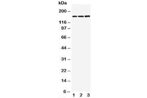 Western blot testing of NMDAR2B antibody and Lane 1:  rat brain;  2: mouse brain;  3: human U87 cell lysate