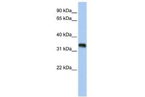 C6ORF140 antibody used at 1 ug/ml to detect target protein. (GLYATL3 Antikörper  (N-Term))