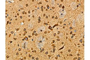 ABIN6265513 and ABIN6276479 at 1/100 staining Mouse brain tissue by IHC-P. (TDGF1 Antikörper  (Internal Region))
