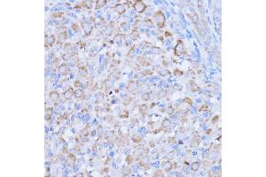 Immunohistochemistry of paraffin-embedded rat ovary using MT-ND1 antibody (ABIN7268598) at dilution of 1:100 (40x lens). (MT-ND1 Antikörper)