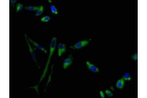 Immunofluorescence staining of Hela cells with ABIN7153315 at 1:100, counter-stained with DAPI. (G Protein-Coupled Receptor 1 Antikörper  (AA 308-355))