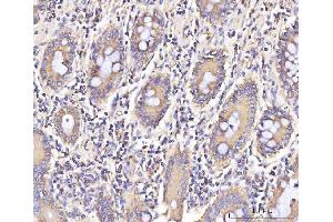 IHC analysis of IFIT5 using anti-IFIT5 antibody (ABIN7600752). (IFIT5 Antikörper  (AA 23-439))