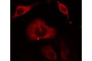ABIN6274657 staining Hela cells by IF/ICC. (Cytochrome P450 3A4, 3A5 Antikörper)