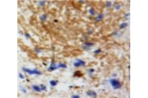 IHC-P analysis of Brain tissue, with DAB staining. (Neurotrophin 3 Antikörper  (AA 130-255))