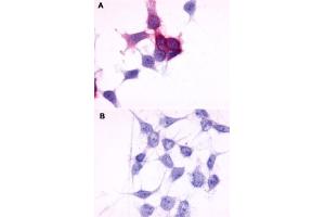 Immunocytochemistry (ICC) staining of HEK293 human embryonic kidney cells transfected (A) or untransfected (B) with P2RY6.