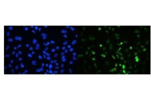 anti-Tripartite Motif Containing 33 (TRIM33) (AA 1001-1127) antibody