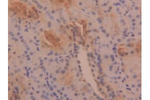 Detection of TPS in Human Kidney Tissue using Polyclonal Antibody to Tryptase (TPS) (TPSAB1 Antikörper  (AA 161-262))