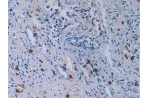 Figure. (TPSAB1 Antikörper  (AA 161-262))