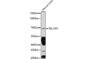 Western blot analysis of extracts of Mouse brain, using TBL1XR1 antibody (ABIN6132717, ABIN6148893, ABIN6148895 and ABIN6217436) at 1:1000 dilution. (TBL1XR1 Antikörper  (AA 1-180))