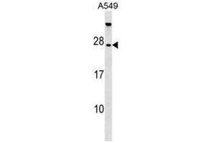 anti-TBC1 Domain Family, Member 28 (TBC1D28) (AA 47-77), (Middle Region) antibody