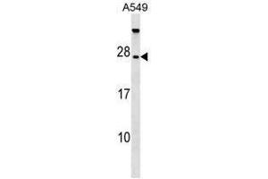 TBC1D28 Antibody (Center) western blot analysis in A549 cell line lysates (35µg/lane). (TBC1D28 Antikörper  (Middle Region))
