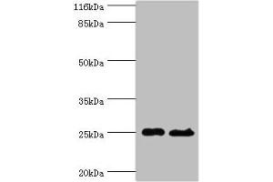 Western blot All lanes: Calcineurin B homologous protein 3 antibody at 2 μg/mL Lane 1: Hela whole cell lysate Lane 2: Mouse brain tissue Secondary Goat polyclonal to rabbit at 1/10000 dilution Predicted band size: 25, 19, 22 kDa Observed band size: 25 kDa (Tescalcin Antikörper  (AA 2-214))