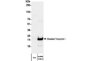 Western Blotting (WB) image for anti-Troponin I (TNNI) antibody (ABIN7795609) (Troponin I Antikörper)