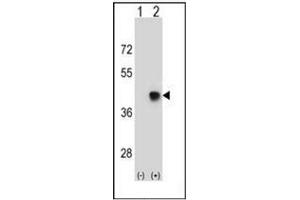Western blot analysis of SPEM1 (arrow) using SPEM1 Antibody (Center) Cat. (SPEM1 Antikörper  (Middle Region))