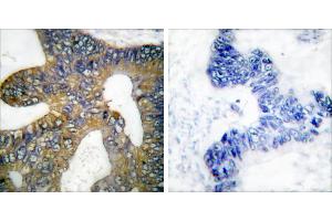 Peptide - +Immunohistochemical analysis of paraffin-embedded human colon carcinoma tissue using HSP105 antibody (#C0231). (HSPH1 Antikörper)