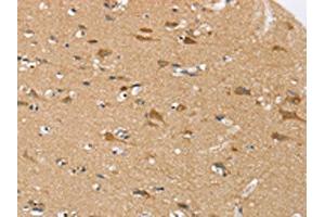 The image on the left is immunohistochemistry of paraffin-embedded Human brain tissue using ABIN7192337(SEZ6L Antibody) at dilution 1/30, on the right is treated with synthetic peptide. (SEZ6L Antikörper)