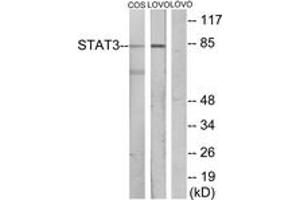 Western blot analysis of extracts from LOVO/COS7 cells, using STAT3 Antibody. (STAT3 Antikörper  (AA 656-705))
