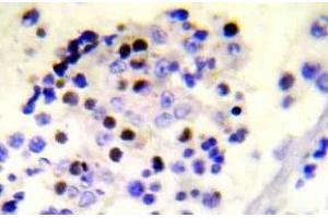 Immunohistochemistry (IHC) analyzes of p-Histone H2A. (H2AFX Antikörper  (pSer139))