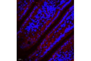 Immunofluorescence (Paraffin-embedded Sections) (IF (p)) image for anti-Linker For Activation of T Cells Family, Member 2 (LAT2) antibody (ABIN7074503)