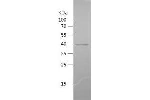 Western Blotting (WB) image for Protein Kinase C, zeta (PRKCZ) (AA 454-592) protein (His-IF2DI Tag) (ABIN7124655)