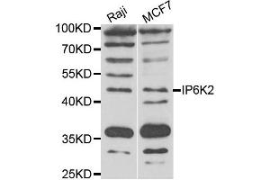 Western blot analysis of extracts of Raji and MCF7 cell lines, using IP6K2 antibody. (IP6K2 Antikörper)