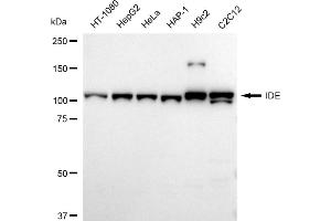 Western blotting analysis using IDE antibody (ABIN7799047).
