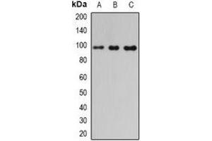 Western blot analysis of PDE6-beta expression in mouse pancreas (A), mouse heart (B), rat liver (C) whole cell lysates. (PDE6B Antikörper)