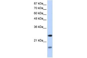 SRP14 antibody used at 1. (SRP14 Antikörper)