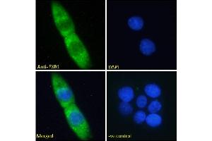 ABIN185683 Immunofluorescence analysis of paraformaldehyde fixed A431 cells, permeabilized with 0.