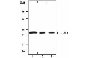 Western blot analysis of Cdk4. (CDK4 Antikörper  (N-Term))