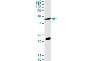 Western Blotting (WB) image for anti-Glucosaminyl (N-Acetyl) Transferase 2, I-Branching Enzyme (I Blood Group) (GCNT2) (AA 1-402) antibody (ABIN947910)