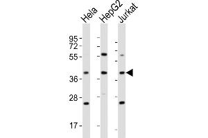 All lanes : Anti-OR5M9 Antibody (C-term) at 1:4000 dilution Lane 1: Hela whole cell lysates Lane 2: HepG2 whole cell lysates Lane 3: Jurkat whole cell lysates Lysates/proteins at 20 μg per lane. (OR5M9 Antikörper  (C-Term))