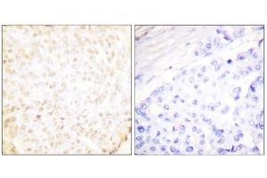Immunohistochemistry (IHC) image for anti-X-Ray Repair Complementing Defective Repair in Chinese Hamster Cells 5 (Double-Strand-Break Rejoining) (XRCC5) (C-Term) antibody (ABIN1848902)